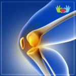 correción protesis de rodilla